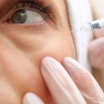 botox-koblenz